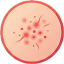 Icon for Red or itchy bite marks on skin