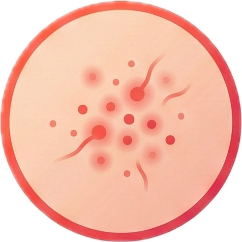 Icon for Red or itchy bite marks on skin