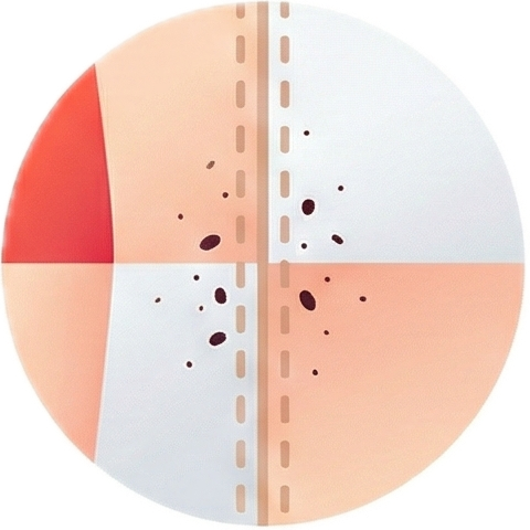 Icon for Dark specks along seams or cracks